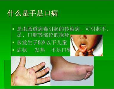 李某手足口案——李冠杰 