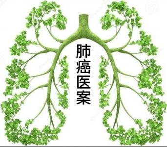 赵某肺癌案——李冠杰 