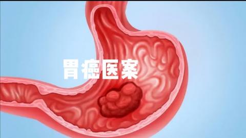 夏某胃癌——李冠杰 